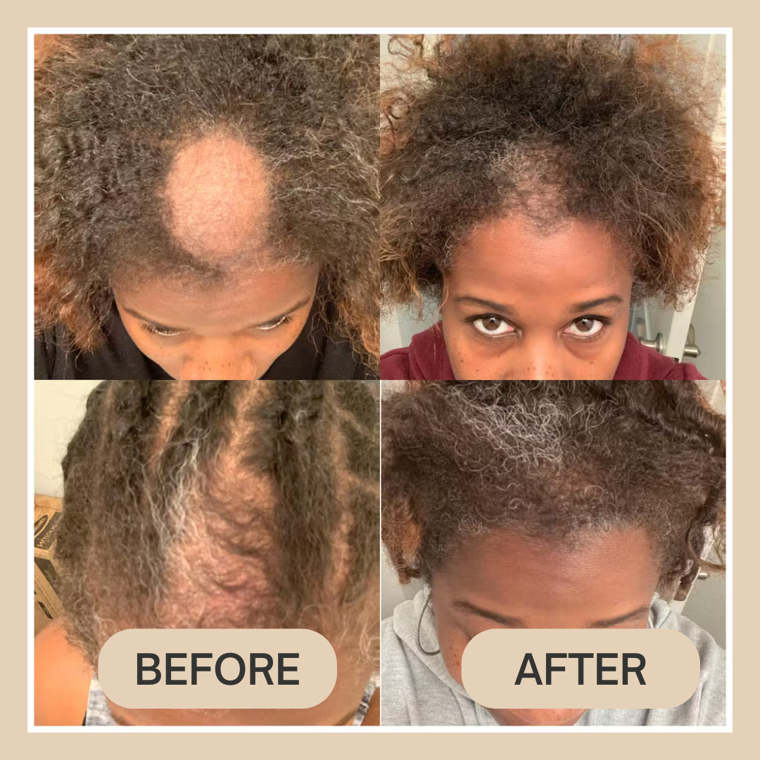 Saviro™ 10 in 1 Hair Growth Oil